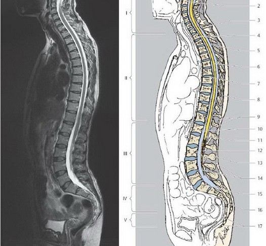 Отделы позвоночника для мрт схема фото и названия